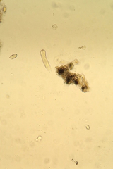 Gastrotricha