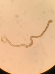 Racomitrium fasciculare