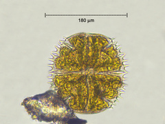 Micrasterias truncata