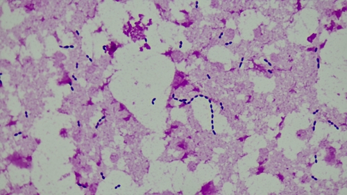 Ruminococcus