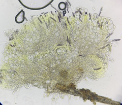 Ascobolus crenulatus