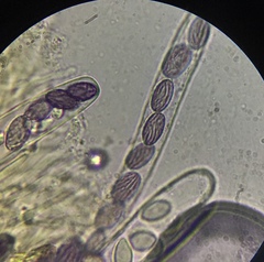 Ascobolus crenulatus