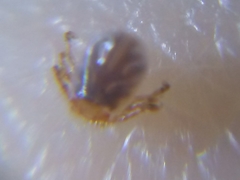 Dermacentor variabilis