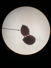 Sphaerobolus stellatus