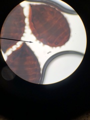 Sphaerobolus stellatus