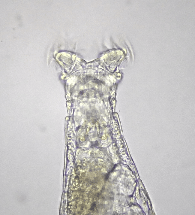 pale-white bdelloid rotifer
