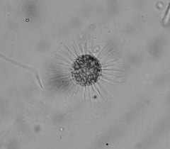 Heliozoa