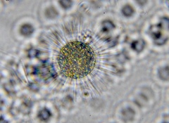 Heliozoa