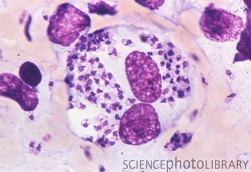 Representative image of Leishmania