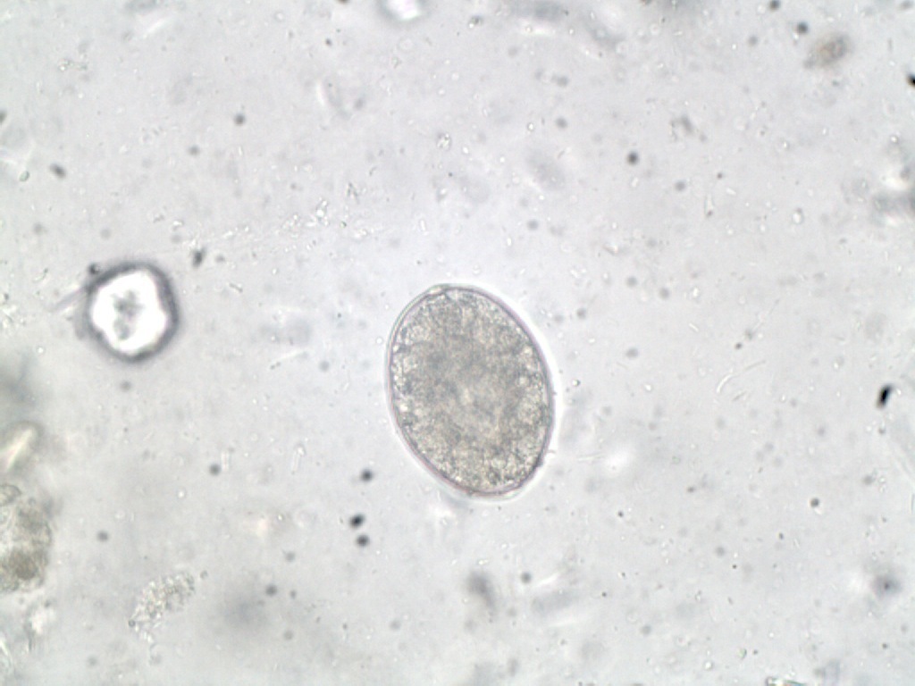 Broad Tapeworm