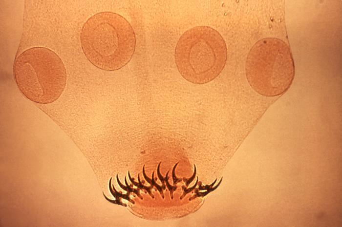 Pork Tapeworm