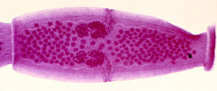 Flea tapeworm