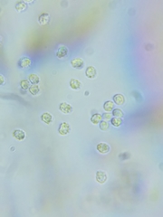 Trechispora mollusca