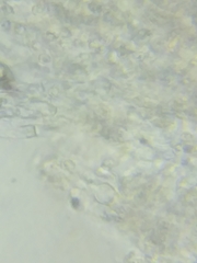 Trechispora mollusca