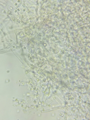 Trechispora mollusca