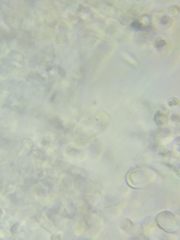 Trechispora mollusca