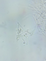 Trechispora mollusca