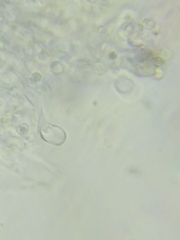 Trechispora mollusca