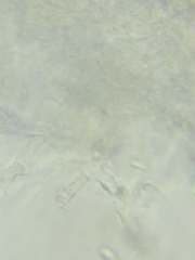 Trechispora mollusca