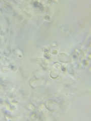 Trechispora mollusca