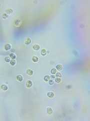 Trechispora mollusca