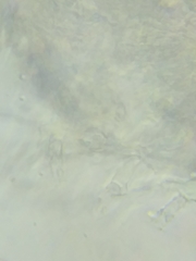 Trechispora mollusca