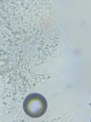 Trechispora mollusca