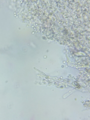 Trechispora mollusca