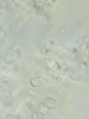 Trechispora mollusca