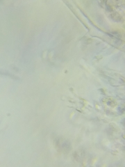 Trechispora mollusca