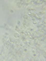 Trechispora mollusca