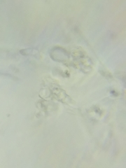 Trechispora mollusca