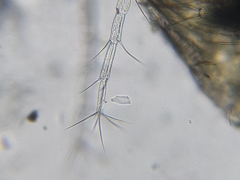 Macrocyclops albidus