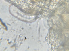 Mesocyclops leuckarti