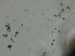 Chaenothecopsis perforata