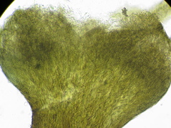 Chaenothecopsis perforata