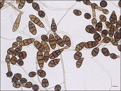 Mancha-de-alternaria (Alternaria spp.)