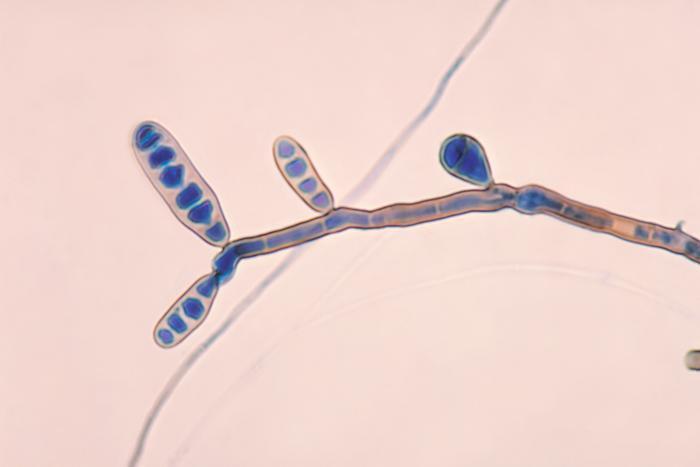 Exserohilum