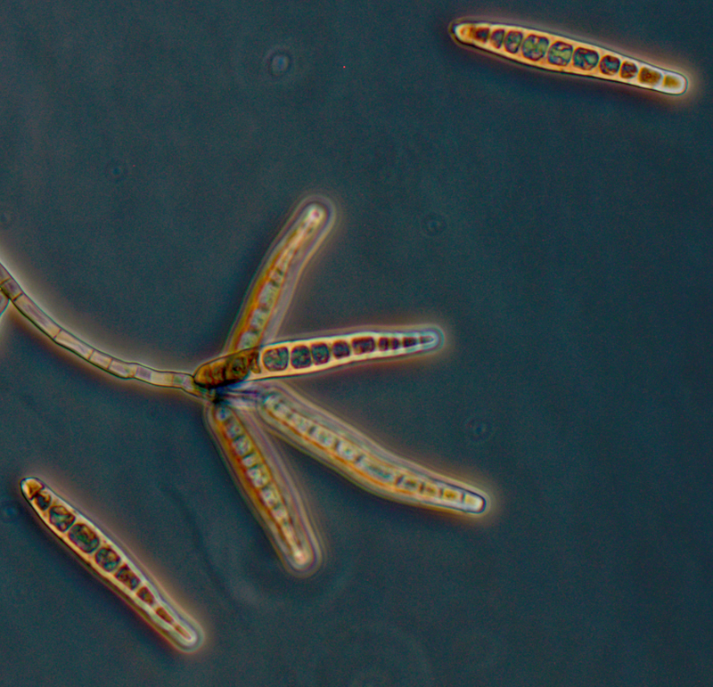 Exserohilum rostratum