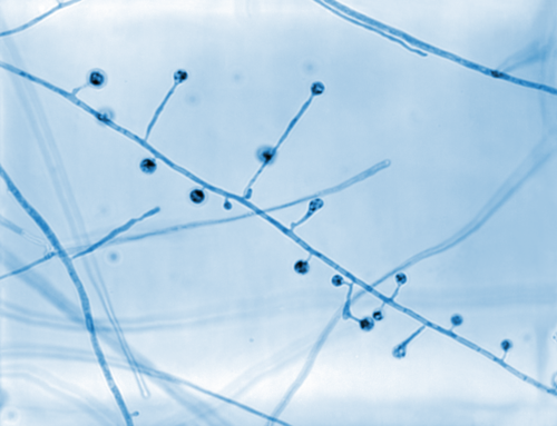 Blastomyces