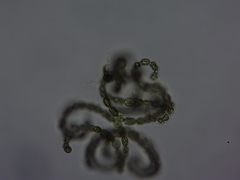 Dolichospermum lemmermannii