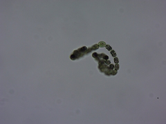 Dolichospermum lemmermannii