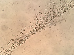 Cornutispora lichenicola