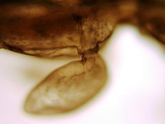 Paracaprella pusilla