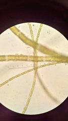Rhizoclonium tortuosum