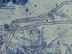 Tomentella ferruginea