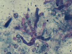 Tomentella ferruginea