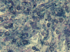 Tomentella ferruginea