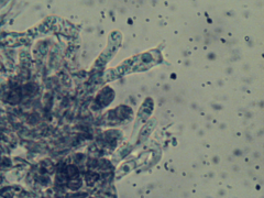 Tomentella ferruginea