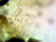 Placopyrenium stanfordii